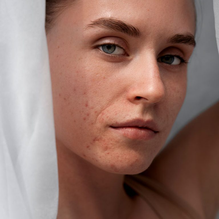 Fractional-Laser