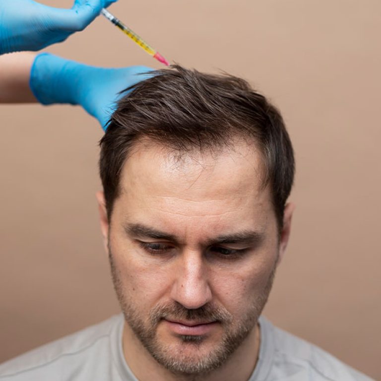 Hair-Restoration